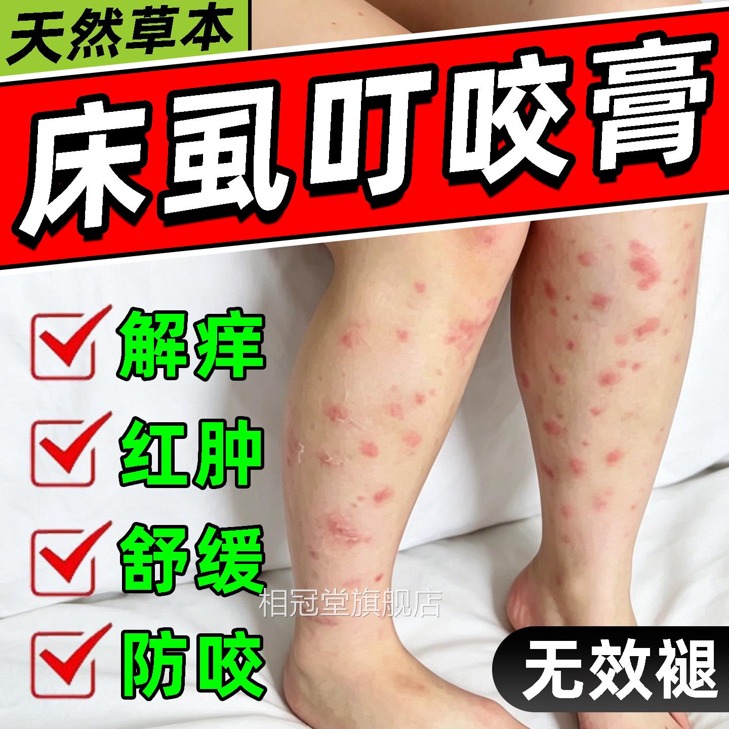 虱叮咬药膏痒肿舒缓青紫草膏跳蚤臭虫子蟑螂床正品官方旗舰店相冠