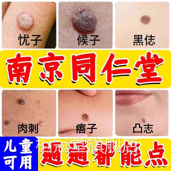 点志膏无痕去非药祛去黑脸部水美容不留疤官方正品旗舰店nn相冠堂