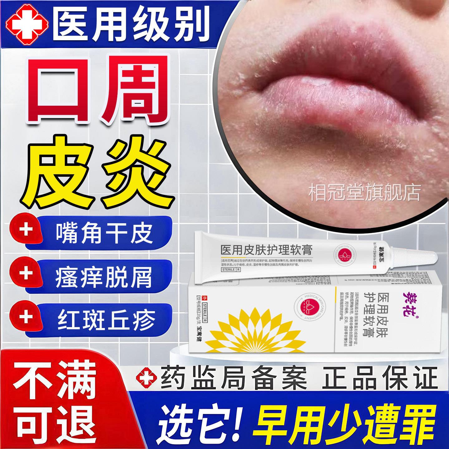 嘴角干燥皮口周皮起炎药膏癣唇周过敏面部脂溢性皮炎医用湿疹软膏