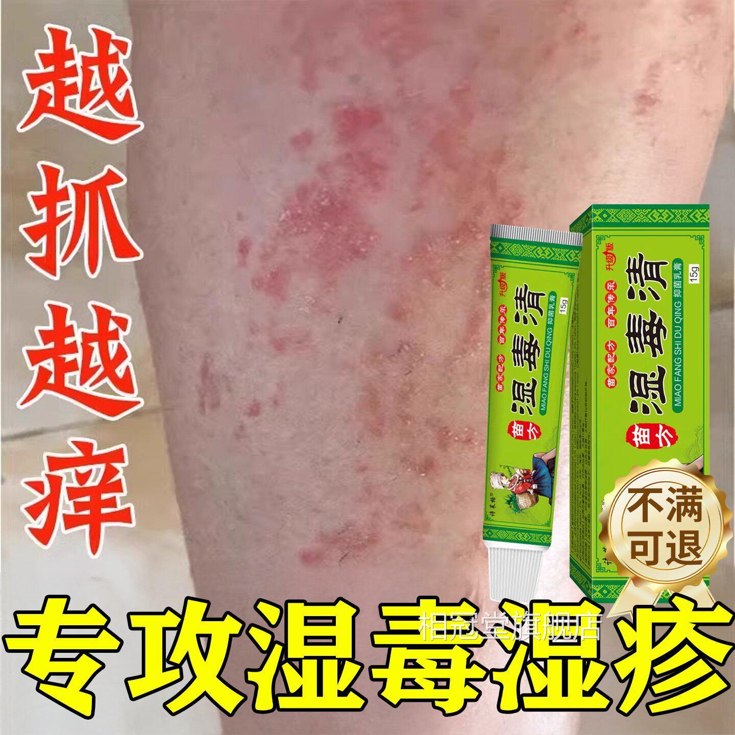 湿毒清软膏湿祛热根湿痒止痒皮肤皮炎瘙痒水泡治除湿专用膏相冠堂