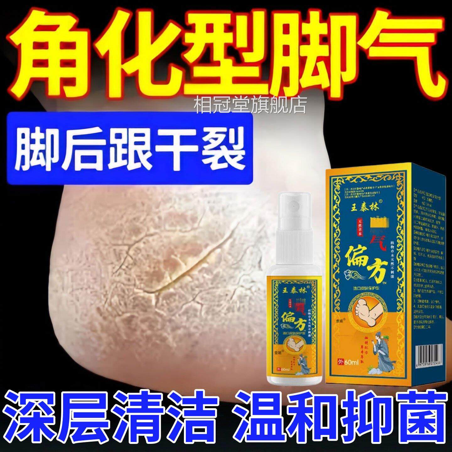 气脚偏方脚气脱真菌感染烂脚丫水泡脚臭喷雾皮抑菌喷剂专用正品相