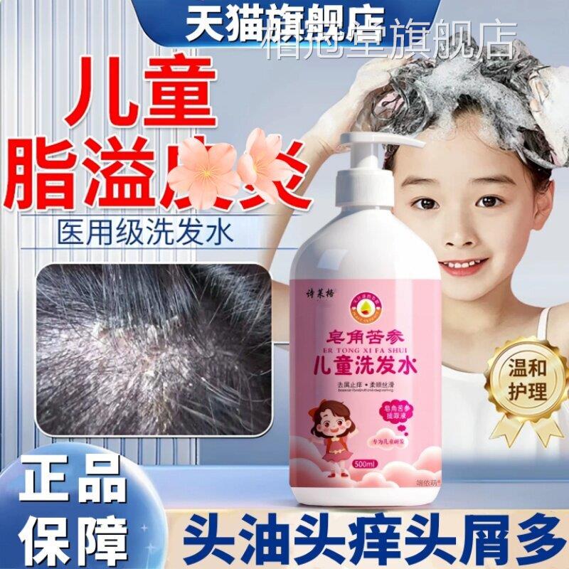 儿童头皮屑去脂溢性皮炎痒真菌感染头癣毛囊炎糠疹专洗发水用头部