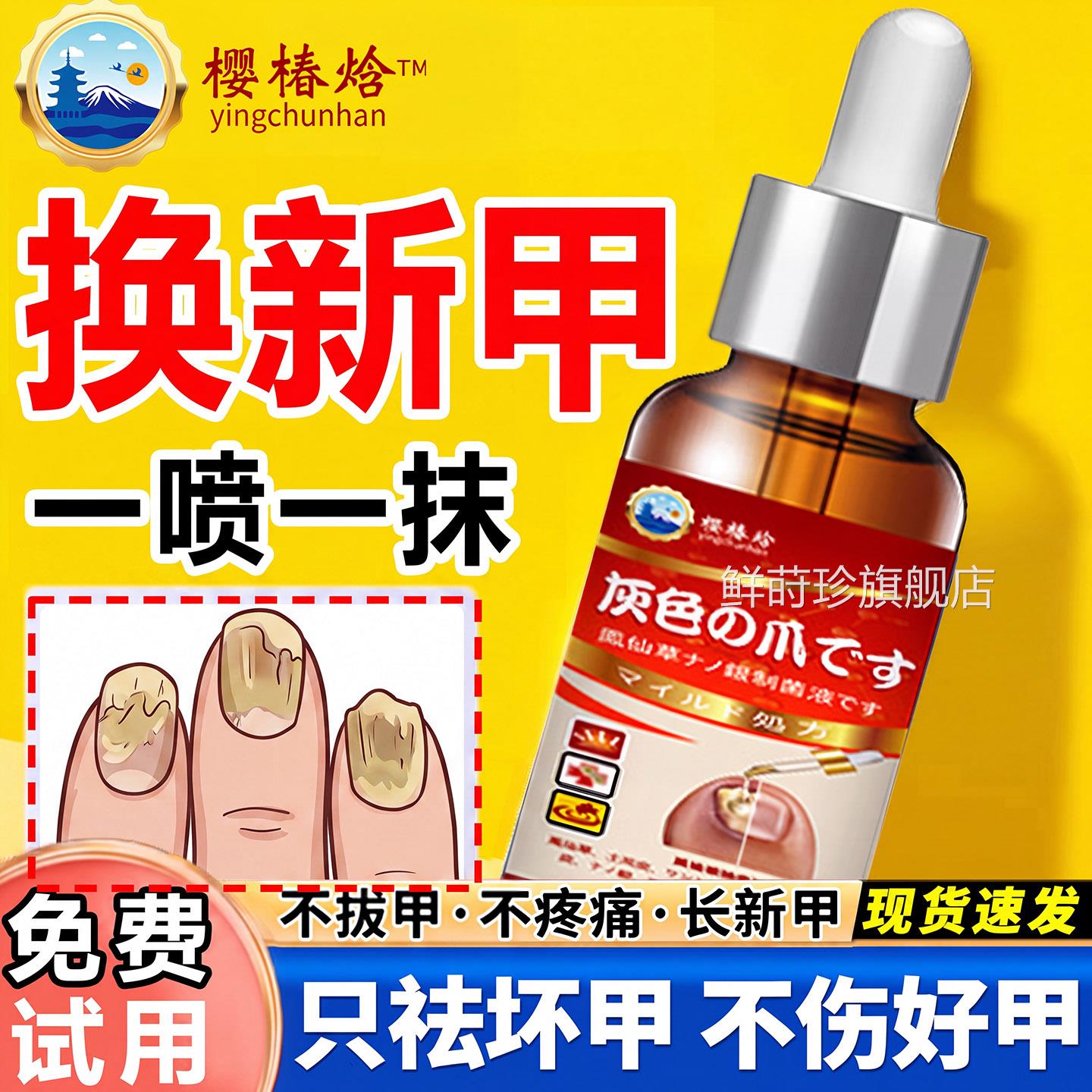 指甲凤灰仙花用药治疗脱灰指甲非日本醋酸专抑真菌官方旗舰店正品