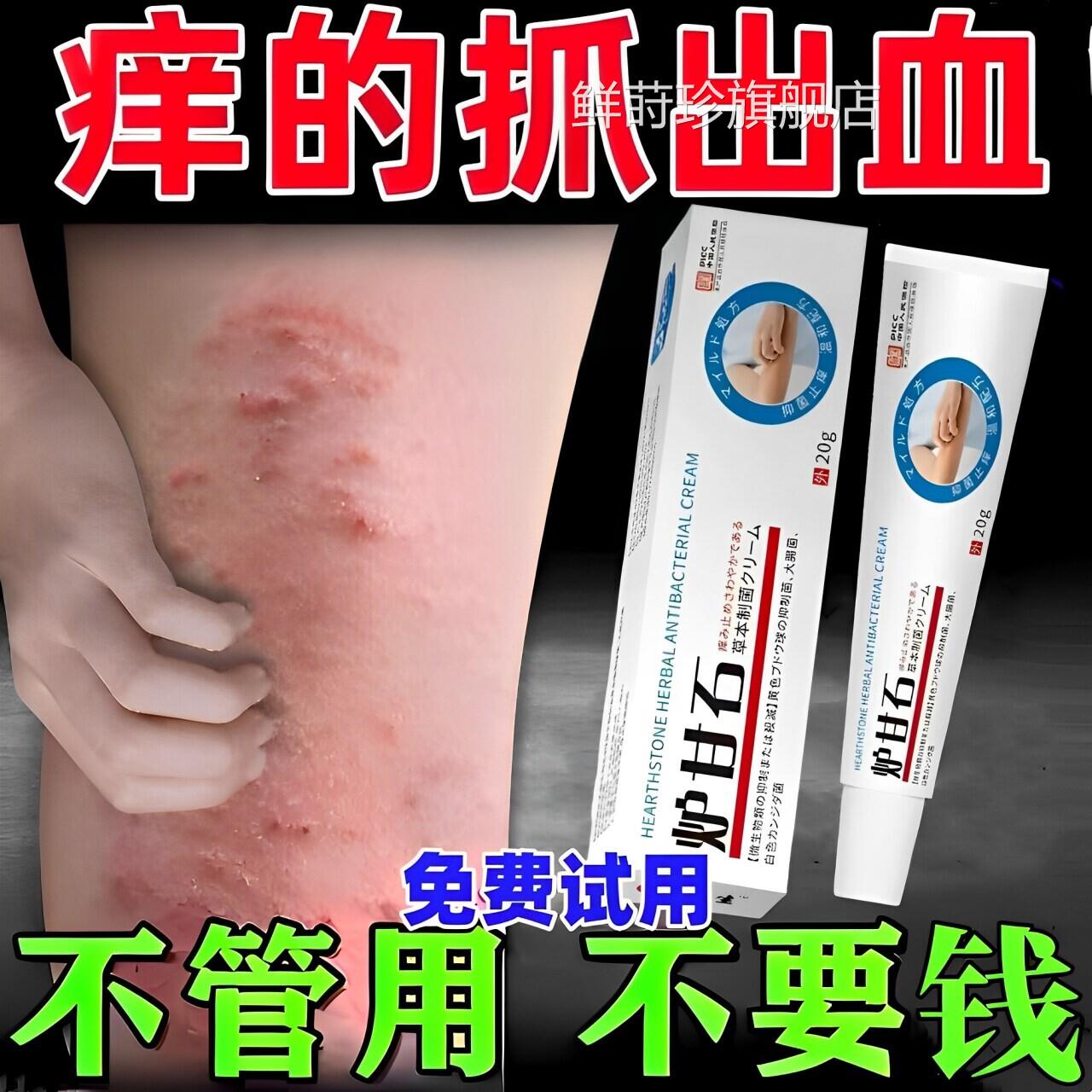 甘石抑菌止痒软膏婴儿专用疹湿根去炉外用顽固皮炎皮肤瘙痒乳膏膏