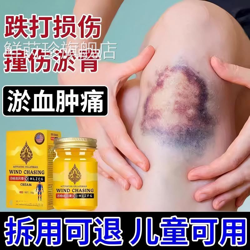 淤青快速除活血化瘀膏婴儿童宝消宝眼部脸上腿磕碰撞伤发紫外用鲜