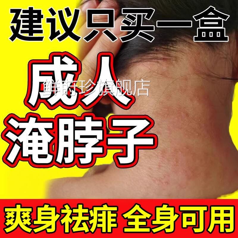 成人痱粉子湿防淹疹脖子非止夏季痒用吸汗干爽身粉女士男士鲜莳珍