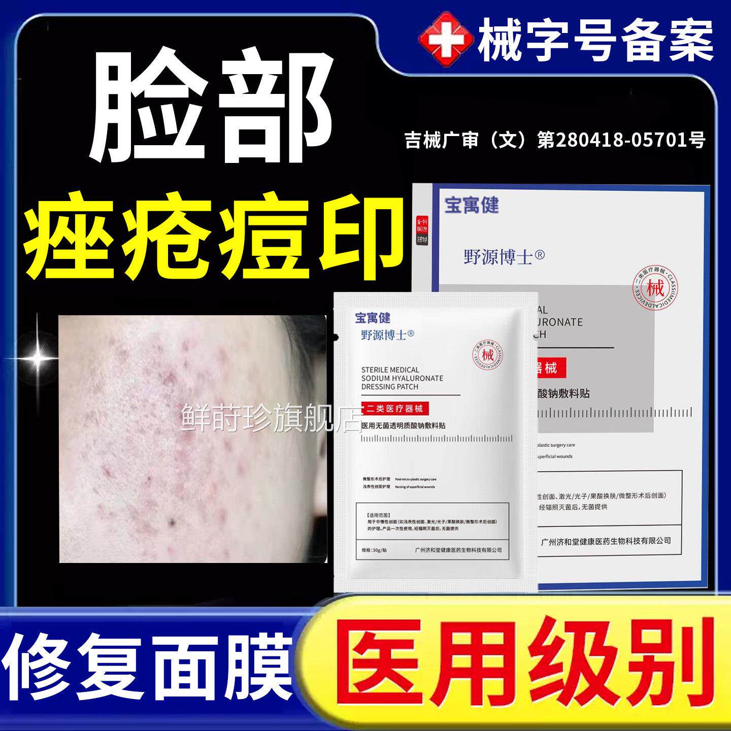 脸部痤疮医面膜械号用祛玫痘除瑰痤疮屏障痘痘修复消痘印毛囊炎痘