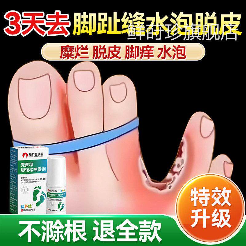 烂脚丫专染用脚趾缝脱皮脚痒糜烂开裂水泡脚臭汗脚气去真菌感喷剂