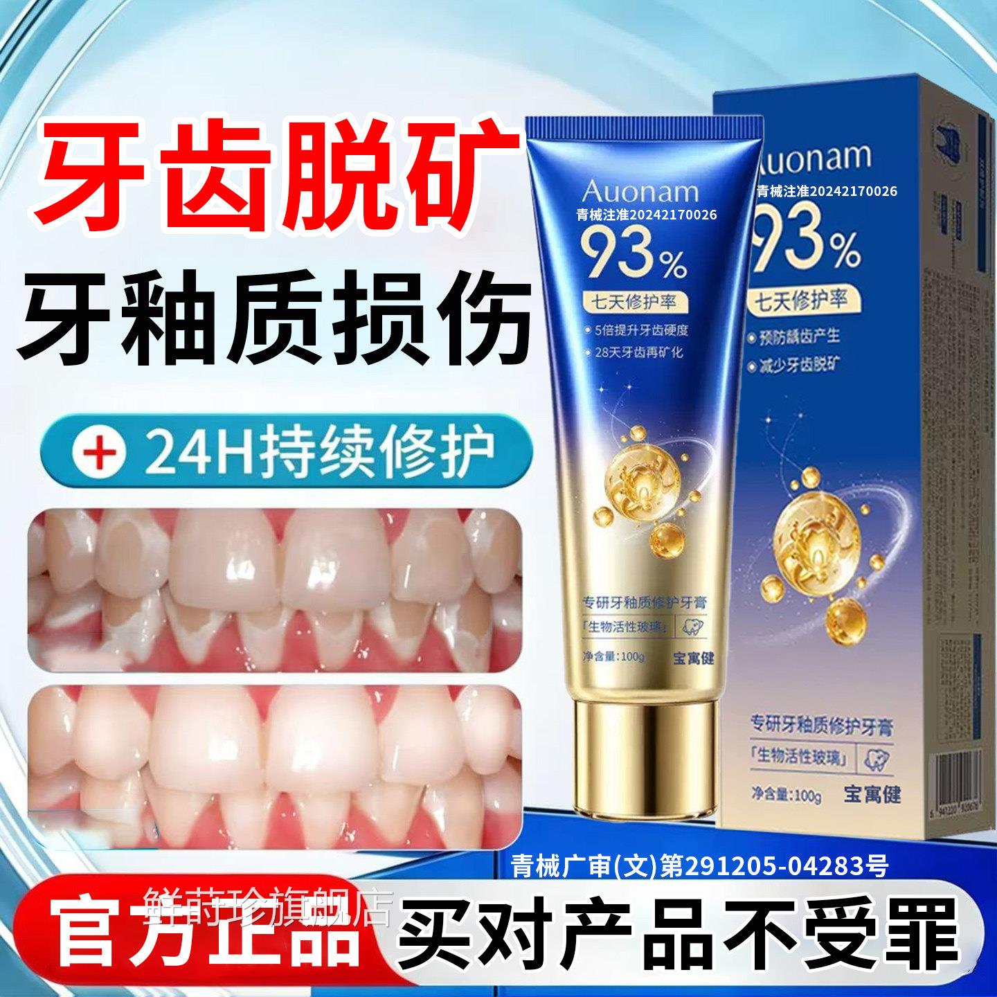 牙齿专脱|矿膏修|复牙釉质含氟防白斑钙化再矿儿童成人用补护牙素