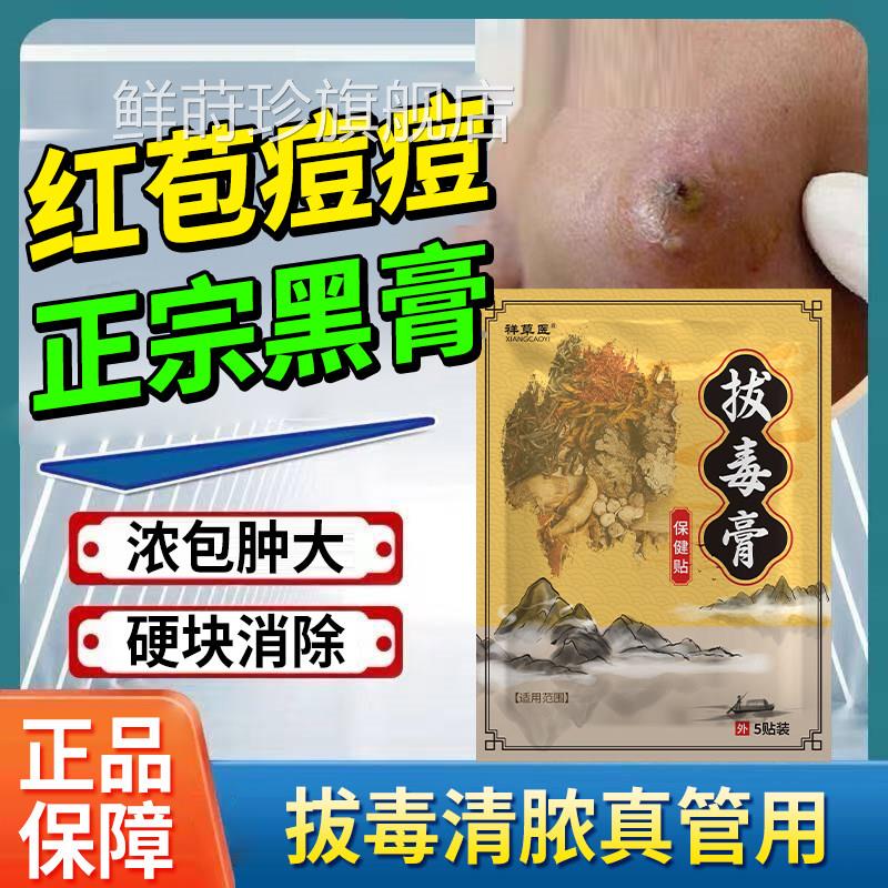 拔毒拔脓黑膏贴子屁股脓包大红包坐板疮红肿硬块火疖痘痘痛黑膏贴