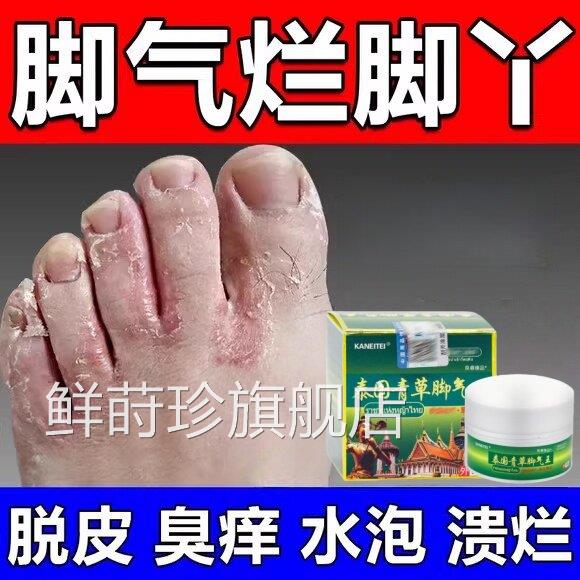 泰国青草脚气王正品脚臭烂脚水泡脱皮底真菌感脚染用专秘方脚气膏
