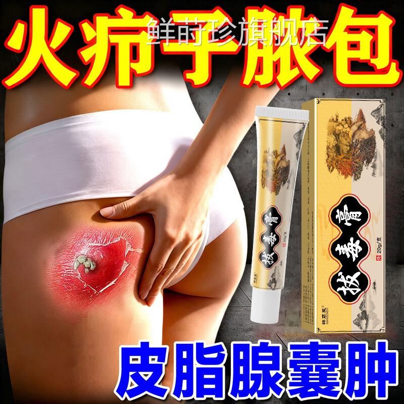火疖子专用软膏拔毒膏脓包疙瘩皮脂腺囊吸脓敷料贴拔毒肿膏鲜莳珍