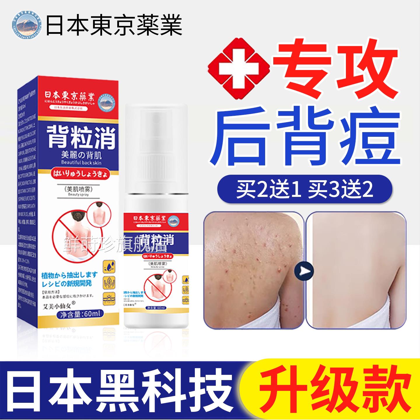 去日本背粒消喷雾前胸后背祛痘背后除螨除背部痘痘除螨虫粉刺正品