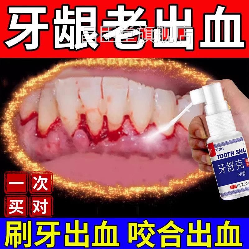 云南白药喷牙膏牙周炎牙龈出血专用牙膏剂牙龈脓包肿痛消炎脱敏UU