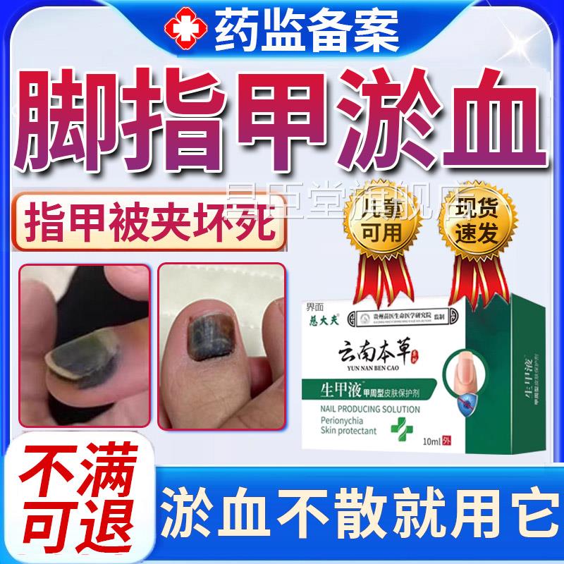 脚趾甲被砸指甲被夹压受损瘀血发黑甲床受伤甲下变黑紫发修复液uu