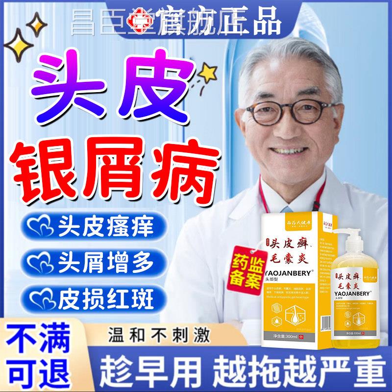 头皮牛皮藓银屑病用药膏专洗发水头皮屑脂溢性皮炎真菌感染头癣UU