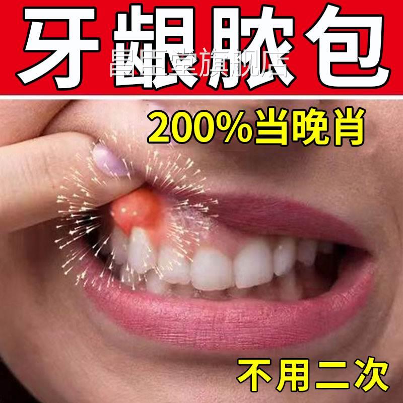 一秒消包疼】牙龈肿包痛瘘管上火智齿牙齿流脓修复牙根周发炎喷剂