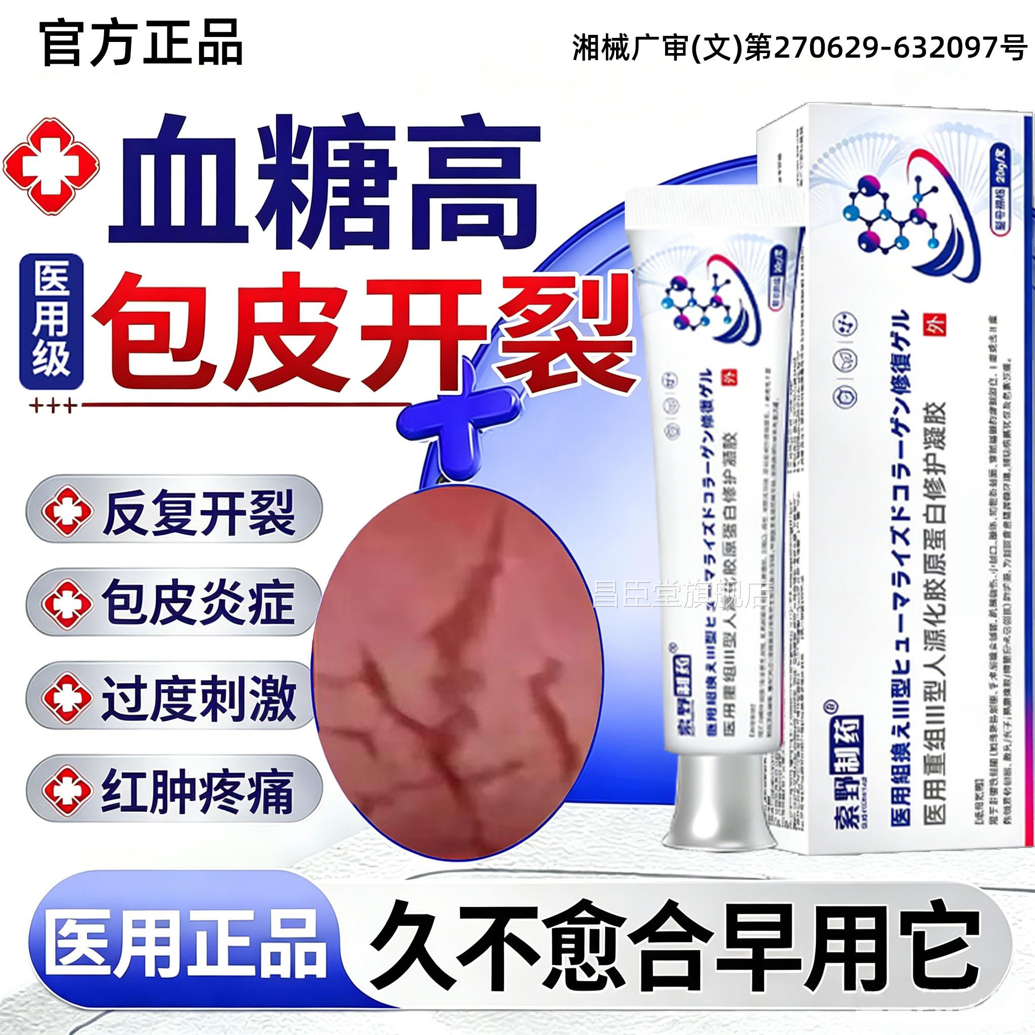 男性阴茎龟头包皮带撕裂裂口系开裂发炎水肿修复龟头炎红肿烂BD昌
