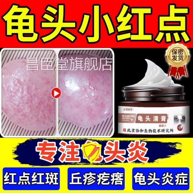 官方正品男性龟头上有起龟小红点瘙疙瘩痒真菌感染霉菌性头炎症膏
