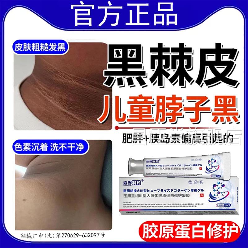 淡化脖子去黑色素沉淀去除深层清洁儿童黑治棘皮病搭药膏医用型BD