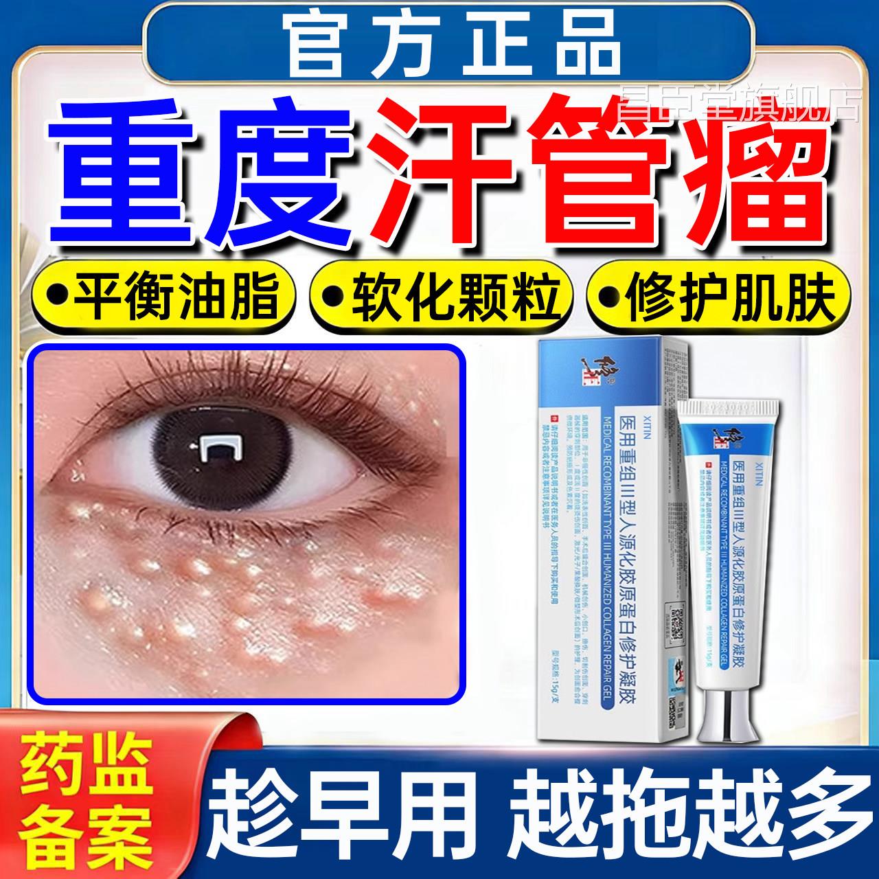 汗管瘤眼部去除神脂肪粒扁平疣眼周消除小疙瘩专药器膏用旗舰店PP