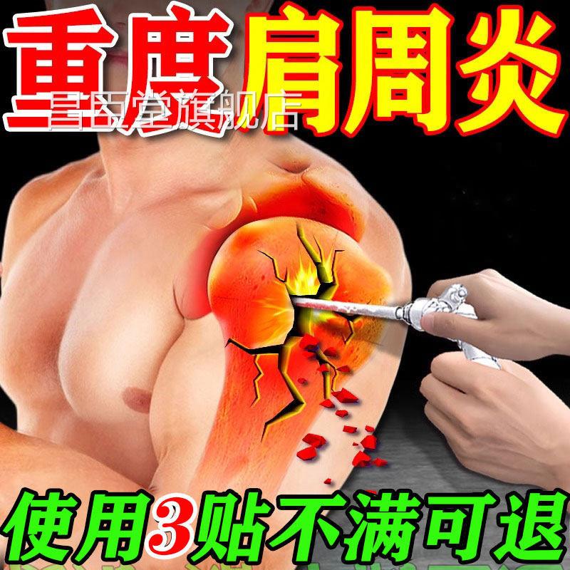 肩周炎酸专用贴膏肩膀痛抬不起胳膊肩袖损伤远红外肩周疼痛膏贴昌