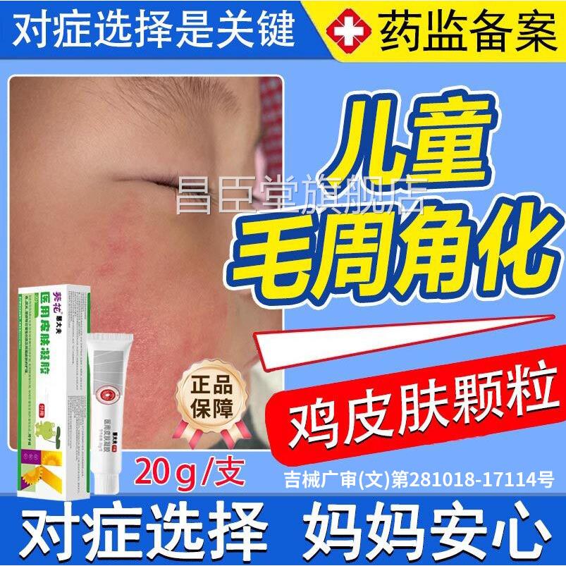 葵花毛周角化症儿童小颗粒去除用鸡皮肤脸上毛囊角化药专房同售ZY