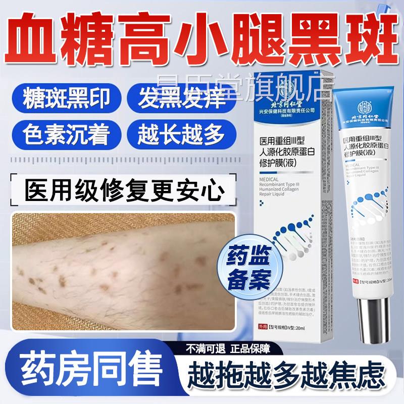 血糖高小腿胫前黑斑糖尿疤痕印去除糖斑专用皮肤痒病药房同售膏QQ