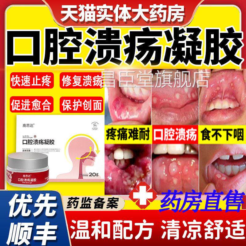 鹿思达口腔溃疡凝专贴凝胶含胶片散粉软冰硼散用特非一点灵昌臣堂