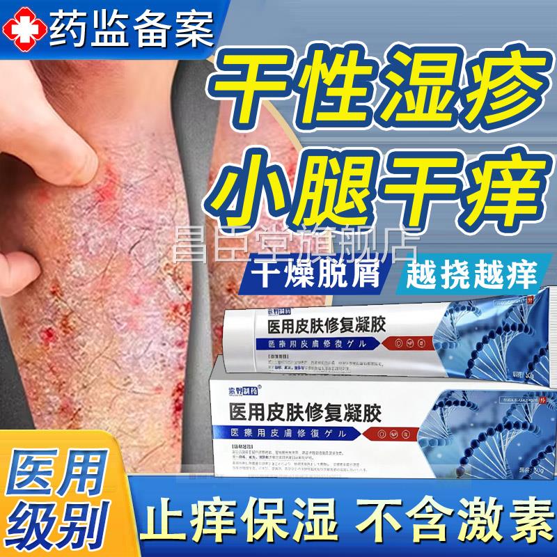 冬天腿痒小腿皮肤干燥瘙痒疹药膏干性湿掉皮屑儿童顽固皮炎止痒TK
