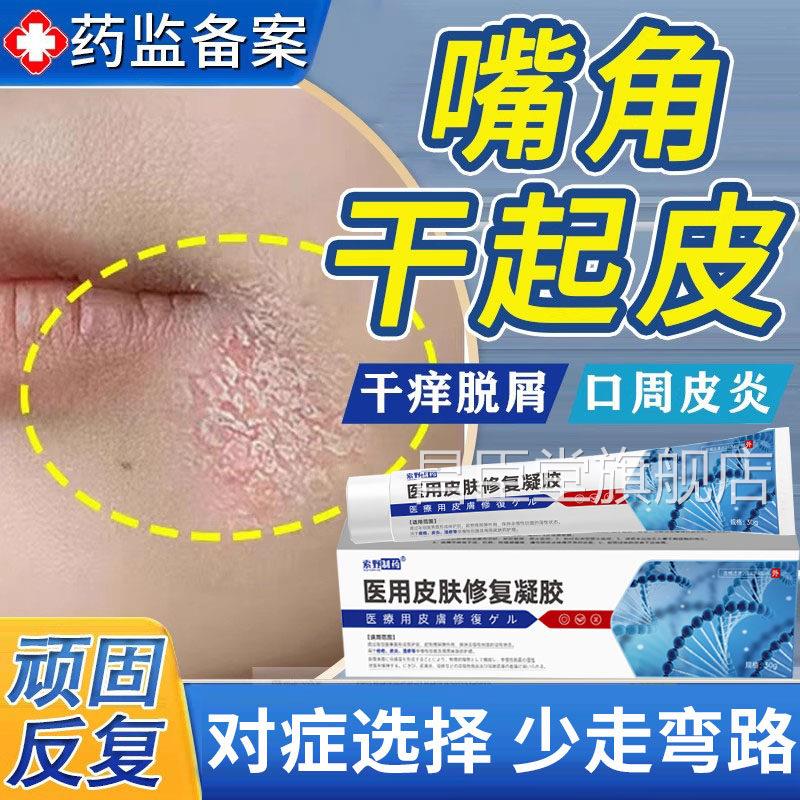 脸上嘴角干燥起皮口周皮炎屑药膏癣干皮有碎脱皮红痒儿童修复膏QQ