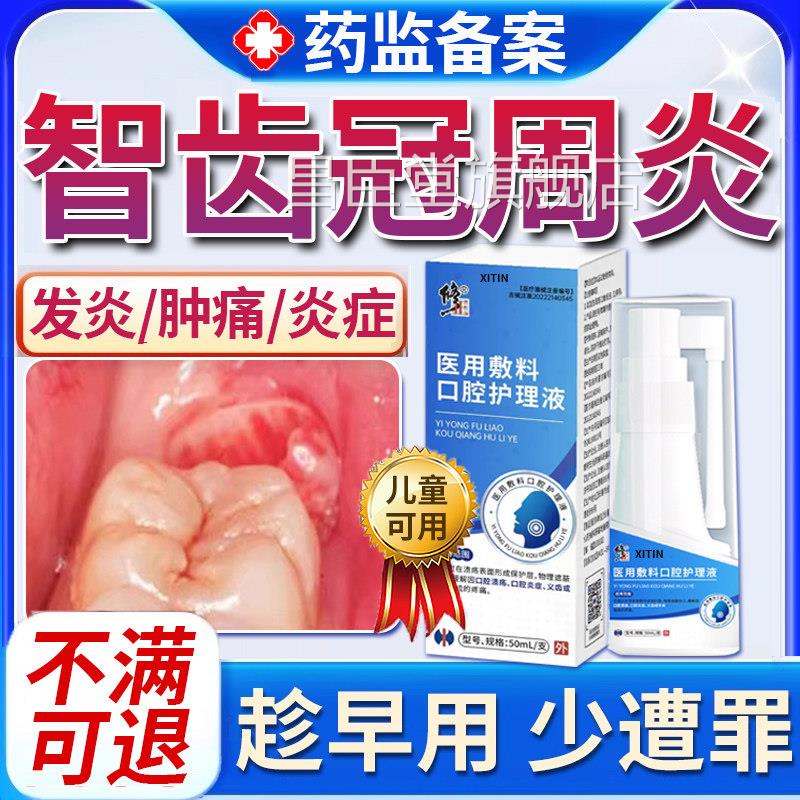 智齿冠周炎牙龈痛脓包肿痛消炎专牙根上火用牙疼牙喷雾喷剂药UU昌