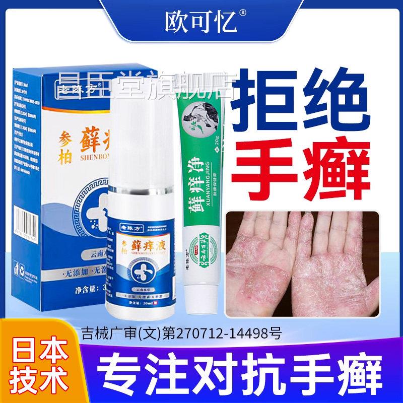 手癣膏脱皮手指手肘关节癣干干裂去止痒真菌感染皮肤病鹅掌 风烂