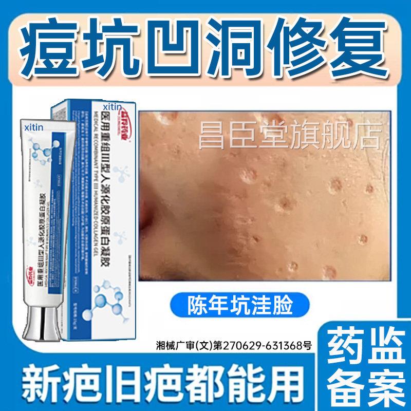 痘坑凹洞修复生长因子痘印修复男医用型淡化凹陷疤痕沉黑色素淀UU