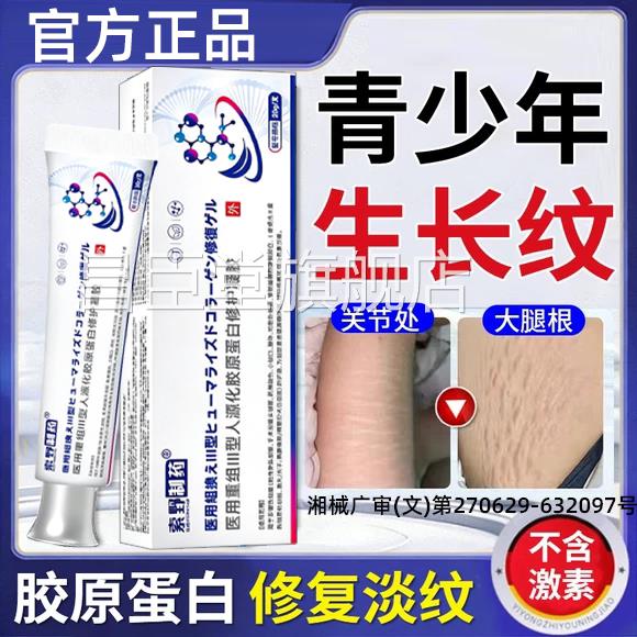 青少年专用去除胖纹生长纹消除大腿学生修复霜国家肥标准医用级XH