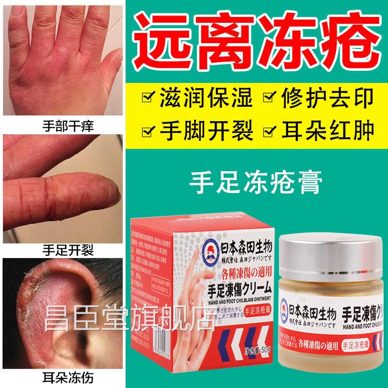 冻疮膏止痒冻伤膏冻药正品防裂膏防冻手足耳朵红肿痒日本特效昌臣