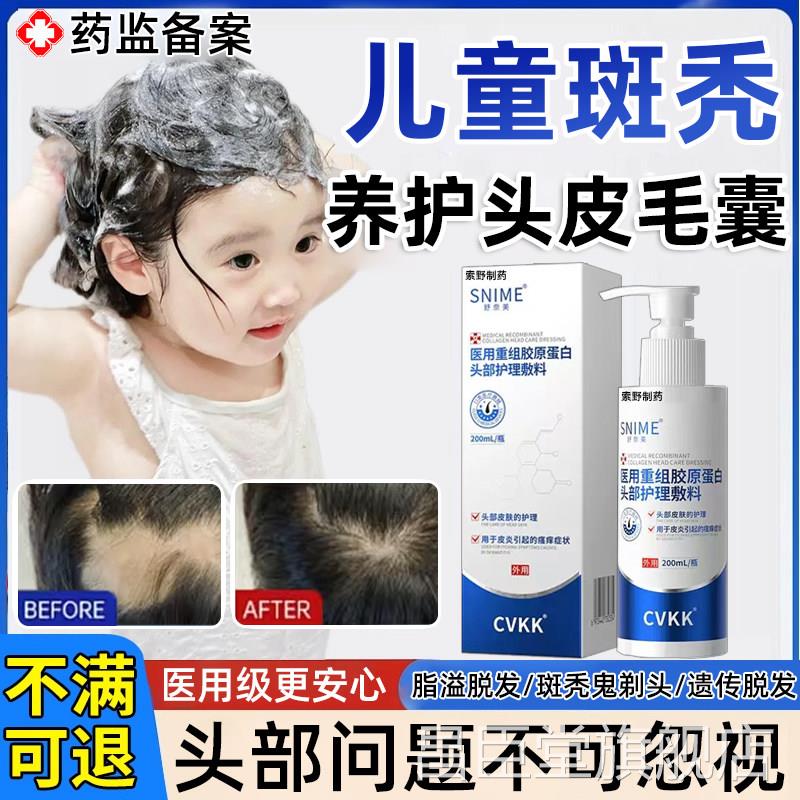儿脱发斑秃专童用洗发水鬼剃头遮盖特防脱膏效生发液药房同售QQ昌