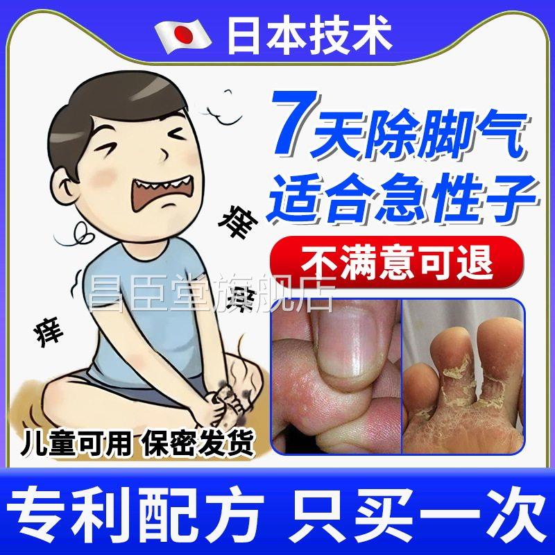 本去日脚气喷雾剂专除臭脚丫痒止脱皮杀水泡菌脚趾缝烂用香港脚膏
