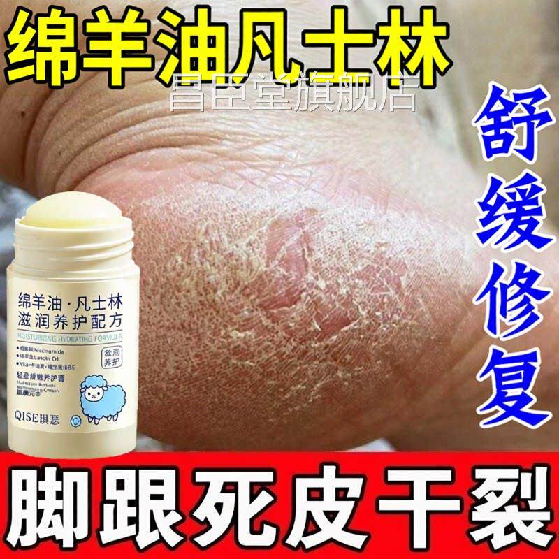 绵羊后油脚跟足跟防干裂起硬皮角化型脚跟气滋润修手足皲裂膏复昌