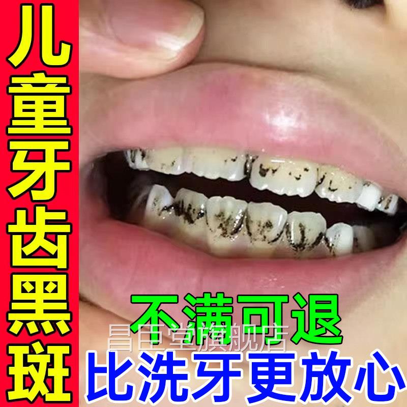 儿童牙齿黑色素沉淀去牙斑牙膏黑菌线 线黑斑黑渍污垢祛除神器美