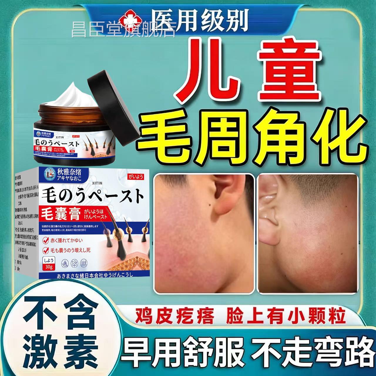 儿童毛周化症儿童有小颗粒去除鸡皮肤疙瘩毛角囊角化症专用脸上UU