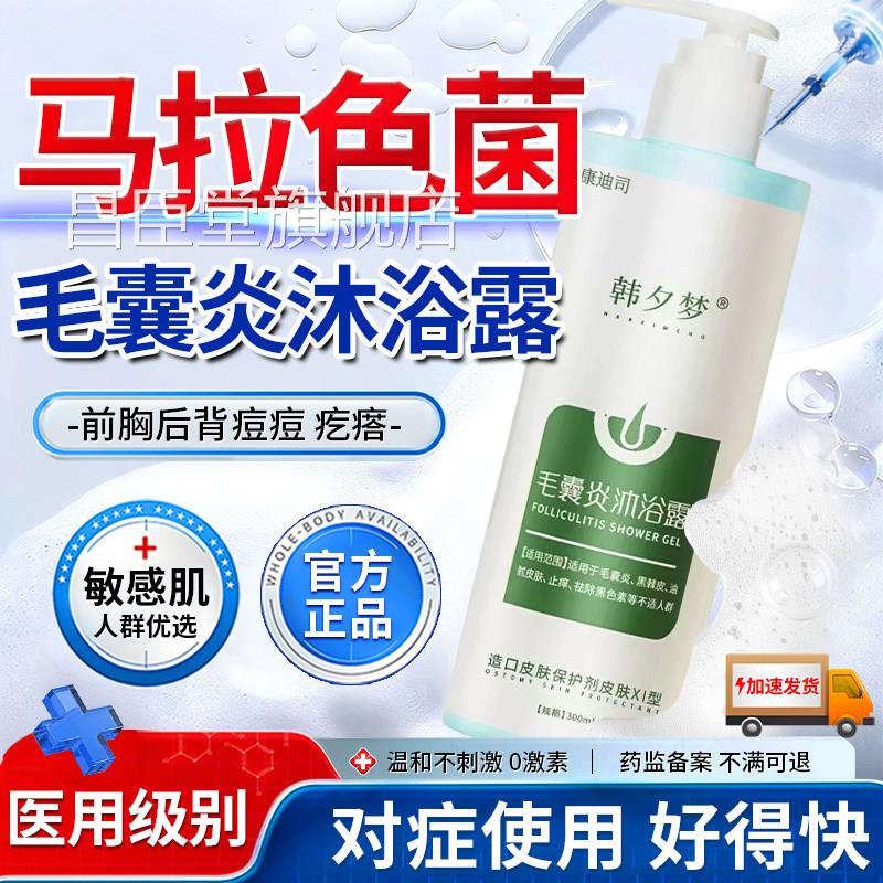 前胸后背长痘痘马拉色毛囊炎专用沐浴露除螨止痒祛痘药房同菌售昌