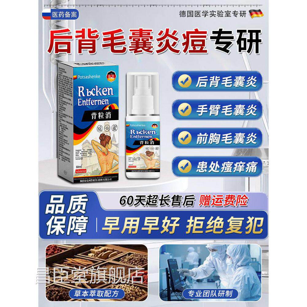 马拉色菌前胸后背背痒后长痘痘毛囊炎除螨祛痘手臂胳膊疙瘩喷雾剂