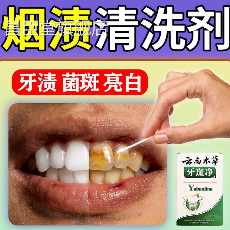 牙官齿烟渍清洗剂强力去污垢结石牙斑净速去黄亮白院线型正品方昌