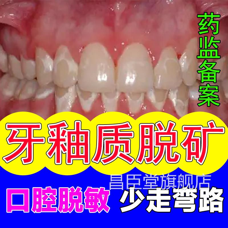 牙敏感酸痛脱矿修覆牙釉质损伤抗过敏可齿搭补矿含氟牙膏使用TO昌