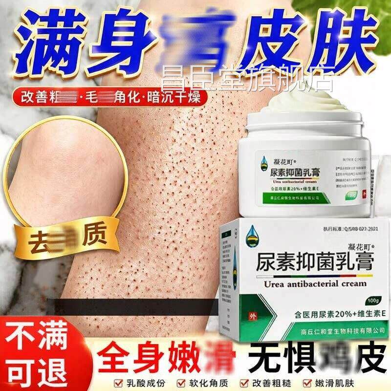 20%用尿素维e膏吉皮肤疙塔囊j化症身体乳改善皮肤干燥毛保湿昌臣