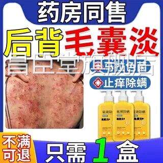 治后背长痘痘毛色囊疗炎专用二硫化硒洗剂药膏马拉菌特沐浴露效FF