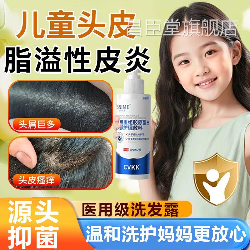 脂医用儿童溢性皮炎头皮屑头癣止痒专用洗发水毛囊炎真菌感染TK昌
