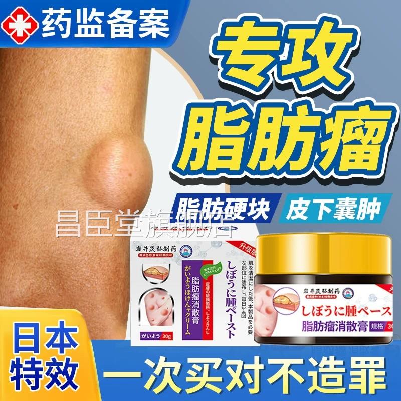 皮下脂肪瘤消膏官方旗舰店专特用效皮肤肿块硬块药膏去除瘤神器昌