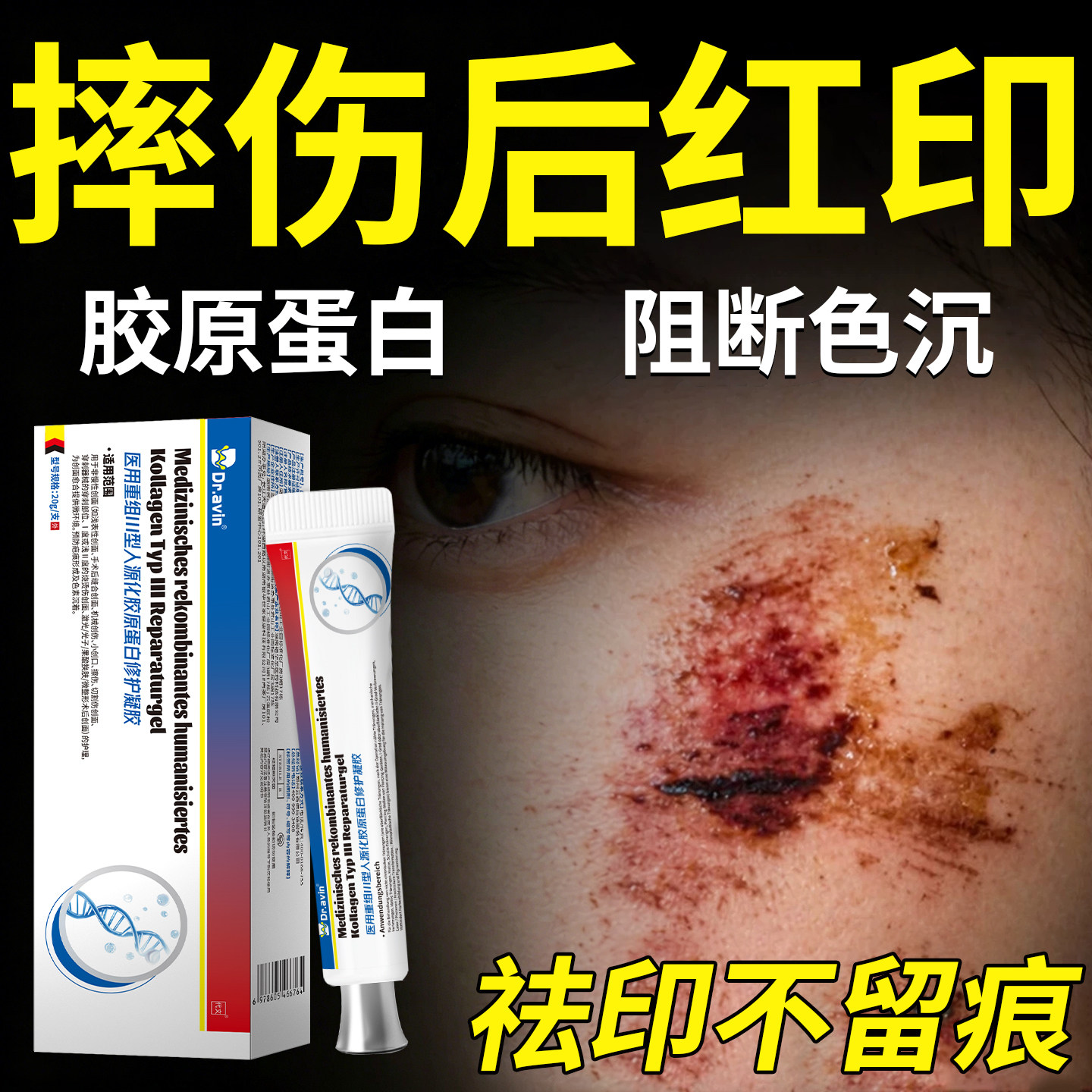 摔伤红疤印【黑色素沉淀】图片